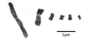 Centromeric Chromosomes